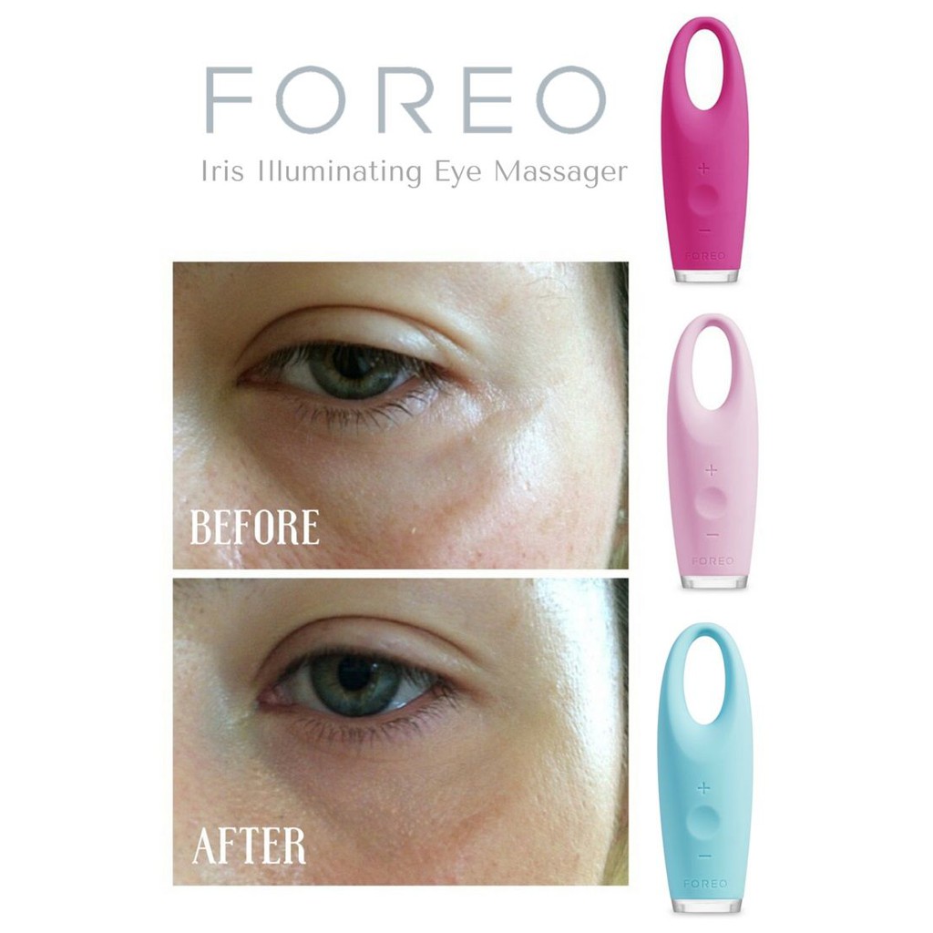 Review máy massage mắt Foreo Iris