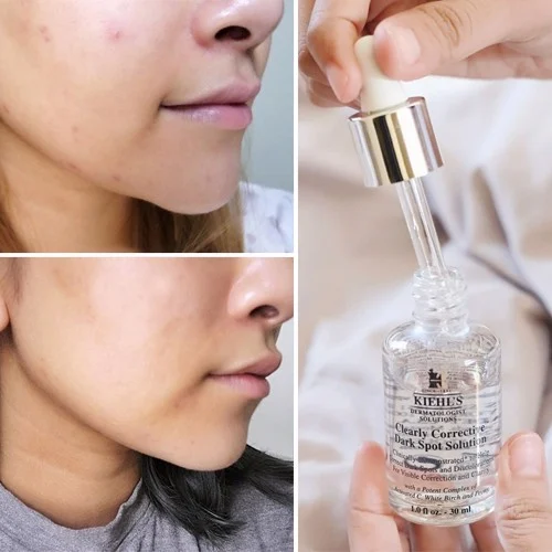 Serum Kiehl's Clearly Corrective Dark Spot Solution 4ml - Cao's Store