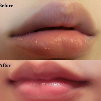 iS Clinical Lip Duo