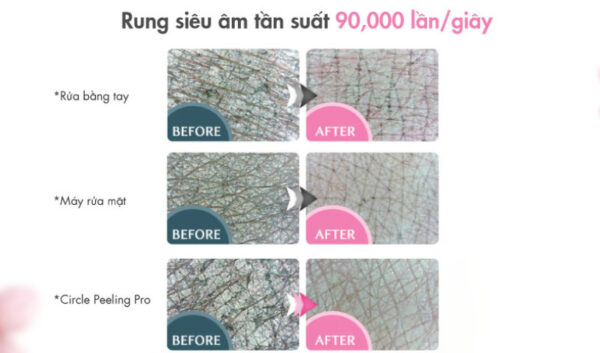 Máy Chăm Sóc Da YA-MAN Circle Peeling Pro HDS-30N - Cao's Store
